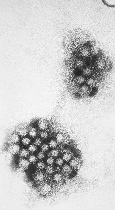 Norovirus Picture