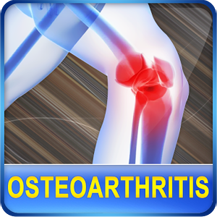 Osteoarthritis Joint Pain Treatment Home Remedies App Icon Picture