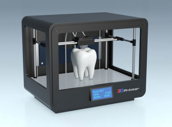 3D Printing Tooth Example Picture